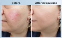 Masajeador Facial Eléctrico Antiarrugas Masaje, Aparato reafirmante que calienta y enfría, herramienta facial ligera con vibración, kit eléctrico para el cuidado de la piel, masajeador facial con 8-21°C frío, 38-47°C calor - details 3