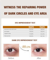 Crema de Ojos de Retinol Adiós a las Arrugas, Reducción de Hinchazón, Reparación y Nutrición de la Piel Herramientas de Cuidado de la Piel Facial - details 8