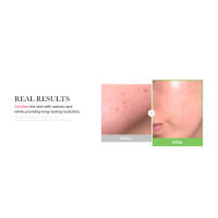 exosome cica cream