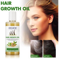 Nutre y fortalece el cabello, proporcionando un cuidado suave y esponjoso. Aceite esencial para el cuidado del cabello. - details 0