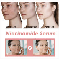 Sérum Facial Coreano Niacinamida Ilumina la Piel, Rejuvenece, Hidrata, Blanquea, Desvanece Manchas y Líneas Finas Herramienta de Cuidado de la Piel de Belleza - details 13