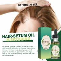 El romero nutre suavemente el cuero cabelludo, espesa, nutre, fortalece y solidifica el aceite esencial para el cuidado del cabello - details 7