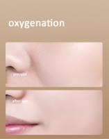 Uso doméstico, iones negativos ultrasónicos, Nano hidratación Facial, EMS, dispositivo de introducción de vibración de belleza, instrumento de inyección de oxígeno - details 7