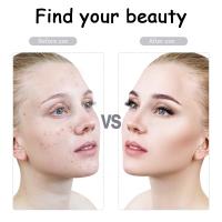 Masajeador Facial de Aleación de Zinc Rodillo Derma Indoloro Micropin Cuidado de la Piel - details 4