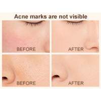 SPF 50+ Hydrating Waterproof Concealer