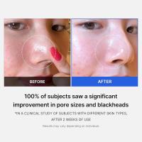 Medicube Zero Pore Pads 2.0, almohadillas de tóner facial de doble textura para exfoliación y cuidado de los poros con 4.5% de ácido láctico AHA y 0.45% de ácido salicílico BHA, ideal para todo tipo de piel, cuidado de la piel coreano (70 almohadillas) - details 1