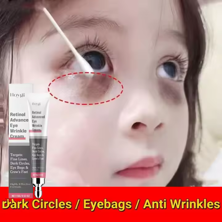Crema de eliminación instantánea de bolsas para ojos, Retinol, antiarrugas, reafirmante, desvanecimiento de la piel, líneas finas, antihinchazón de ojeras, ilumina el cuidado de los ojos - 1