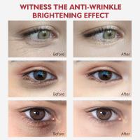 Crema para los Ojos Nicotinamida Elimina Ojeras y Bolsas con Ácido Hidratante - details 1