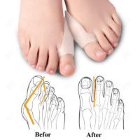 EiD-Gel de silicona separador de dedos de los pies, plantillas para juanete, ajustador de ectropión, Corrector de Hallux Valgus, almohadillas para el cuidado de los pies - details 17