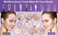 Kit de herramientas para espinillas, 10 piezas, extractor profesional de comedones para una fácil eliminación de espinillas, puntos negros, eliminación de zit, facial y nariz, kit de eliminación de acné con caja de metal - details 1
