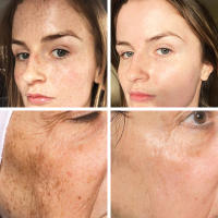 Suero Blanqueador Corrector de Manchas Dark Spots Iluminador de Piel para Día y Noche - details 0