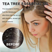 Aceite esencial de árbol de té para reparar el cabello, hidratante para la piel Facial, esencia para uñas grises hidratante y reparadora - details 7