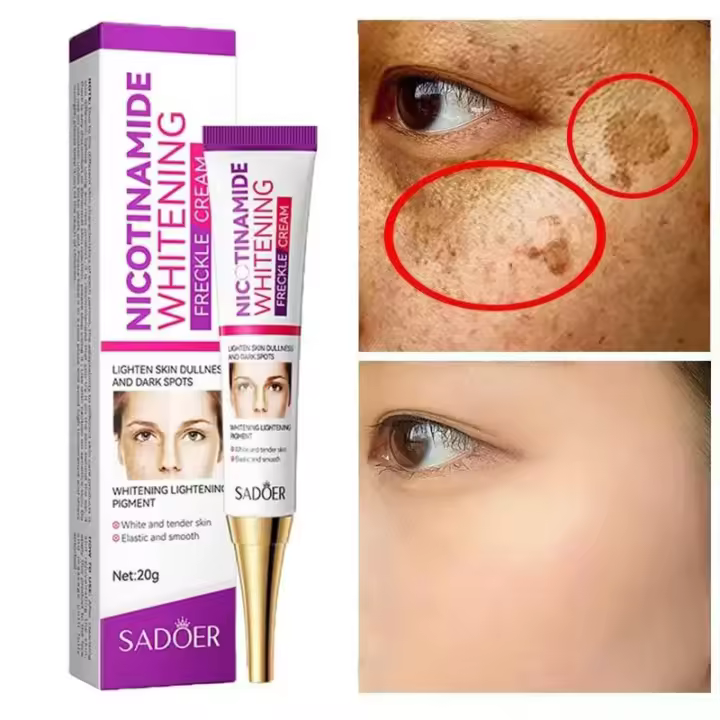Crema Blanqueadora de Manchas de Melasma Nicotinamida Ilumina el Tono de Piel, Hidrata y Reduce las Manchas Herramienta de Cuidado de la Piel de Belleza - 1