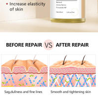 Suero de retinol hidratante reafirmante cuidado de la piel solución original cosmética - details 4