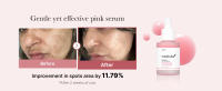 pdrn, glow serum, pink glow serum, vegan pdrn, dark spots, fine lines