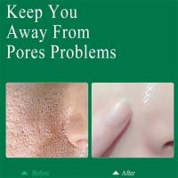 Crema Reductora de Poros de Ácido Salicílico Adiós a los Pulgares, Reparación de Piel, Estiramiento - details 16