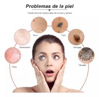 Herramienta Para Quitar Verrugas, Pluma Cauterizador - details 3