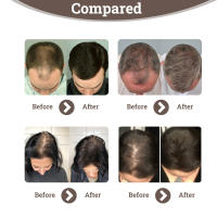 Dense para prevenir la caída, fijar y reparar el spray para el cuidado del cabello denso, fuerte y grueso - details 8