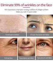 Crema Anti-Arrugas Retinol Blanqueo Inicial de Piel de Cara y Ojos Adiós a las Manchas Dark - details 2