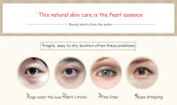 Crema ojos BIOAQUA Firmación anti-hinchazón Collagén Elimina Ojeras y Dark Circles - details 1