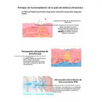 Ultrasones piel pala máquina Ion importador ems microcorriente belleza instrumento Cara poro limpiador - details 6