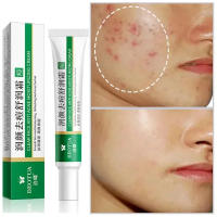 Herbal Acne Treatment Cream Face Scar Blackhead Remover Repair Gel Oil Control Shrink Pores Whitening Skin Care Korean Cosmetics - details 1