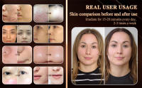 Máscara de Terapia LED para el Rostro Hidrafacial de Luz Roja Plegable 7 Colores de Ciclo - details 2