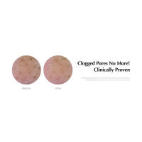 Pore Cleansing