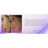 Before and after 3 weeks