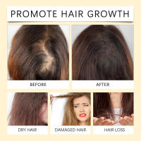 HOEGOA Nut para cabello seco, aceite esencial hidratante, suavizante y potenciador del cuidado del cabello - details 11
