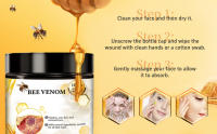 bee venom mole and wart treatment cream  bee venom wart remover bee venom wart and mole removal