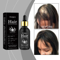 Solución de esencia para el cuidado del masaje diario del cuero cabelludo nutritivo para endurecer el cabello - details 1