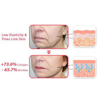 Rodillo de Levantamiento Facial Herramienta de Belleza para Hombres Mujeres y Niñas Massajeador de Escultura Facial Regalo para Novia Tipo de Piel Todo Tipo de Piel con Batería Producto Peludo - details 6