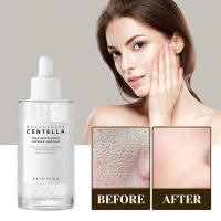 Skin1004 Madagascar Centella Asiatica ampolla suero Facial aceite hidratante cuidado de la piel para iluminar el cuidado de la cara cuidado de la piel - details 3