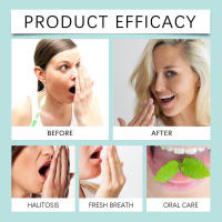 Manchas de aliento fresco, sarro dental, limpieza profunda, olor, sabor limpio, spray para cuidado bucal - details 7