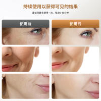 Herramienta de Cuidado de la Piel Facial EMS Instrumento de Alivio del Cuello Nasolabial para Belleza Promoción Grande - details 6