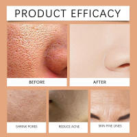 OCEANA Vitamina C Exfoliante Suave Hidratante, Refrescante, Gel Limpiador de Piel Suave y Cuidado de Queratina - details 8