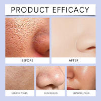 Microaguja azul que reduce los poros, blanqueamiento en esencia Facial, suero de línea fina firme, hidrata la melanina, elimina el producto para el cuidado de la piel - details 4