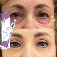 Crema de Ojos de Retinol Eliminación Inmediata de Ojeras Desvanecimiento de Líneas Finas - details 2