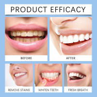 Blanqueamiento dental Eliminación suave de manchas Color amarillento Cuidado bucal refrescante - details 11