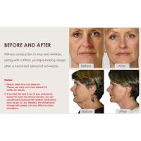 face skin care