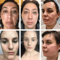 Whitening Freckle Cream Face Brightening Cream Niacinamide Reduce Chloasma Melasma Melanin Fade Fine Lines Lighten Dark Skincare - details 0