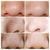 Té verde Original, elimina profundamente los puntos negros, mascarilla de barro para acné, palo, reduce los poros, disipa la crema para el acné, trata las espinillas, cuidado coreano de la piel limpia - details 15
