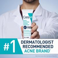 CeraVe Acne Foaming Cream Cleanser, limpiador facial con peróxido de benzoilo al 4% con ácido hialurónico, niacinamida y ceramidas, tratamiento diario suave para el acné para la cara - details 4