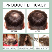 Spray nutritivo para el crecimiento del cabello denso y oscuro, masaje nutritivo del cuero cabelludo con romero - details 6