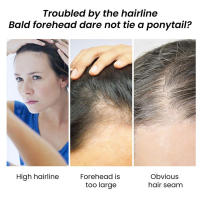 Rolling hidrata el cabello, mejora la furia de la cola y el aceite esencial para el cuidado del cabello esponjoso - details 6