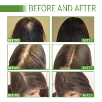 West&Montr hidrata y cuida el aceite esencial para el cuidado del cabello seco, hidratante y suave - details 6
