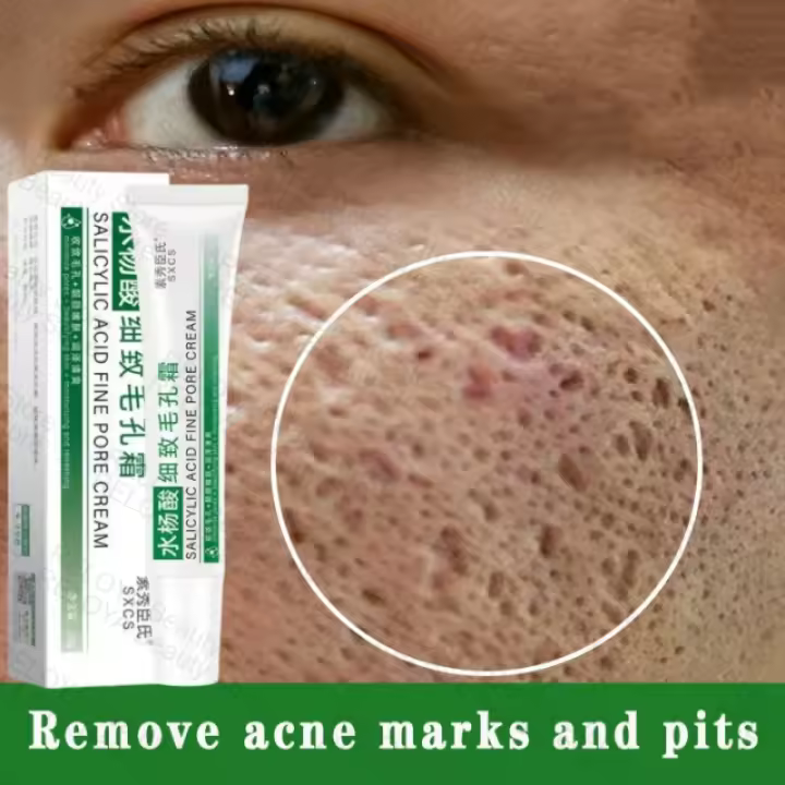 Crema para reducir los poros, eliminación de poros grandes, puntos negros, elimina el acné, Gel de reparación, aprieta la cara, piel suave, productos de cuidado coreanos - 1
