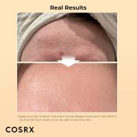 COSRX Best Seller Duo- Crema de Caracol 92 y Esencia de Caracol 96, Gel Hidratante Facial Diario y Suero Hidratante para Cara con Filtro de Secretión de Caracol, Cuidado de la Piel Coreano - details 4