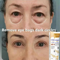 Crema para los Ojos Anti-Hinchazón Reductor de Granos de Grasa Refuerza la Barriera de Piel - details 16
